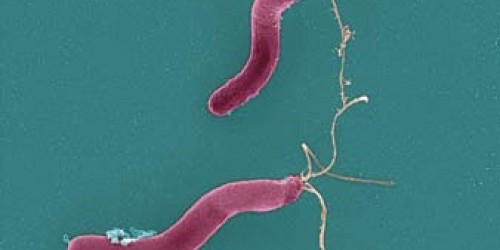 Helicobacter: The Bacteria that Cause Ulcers
